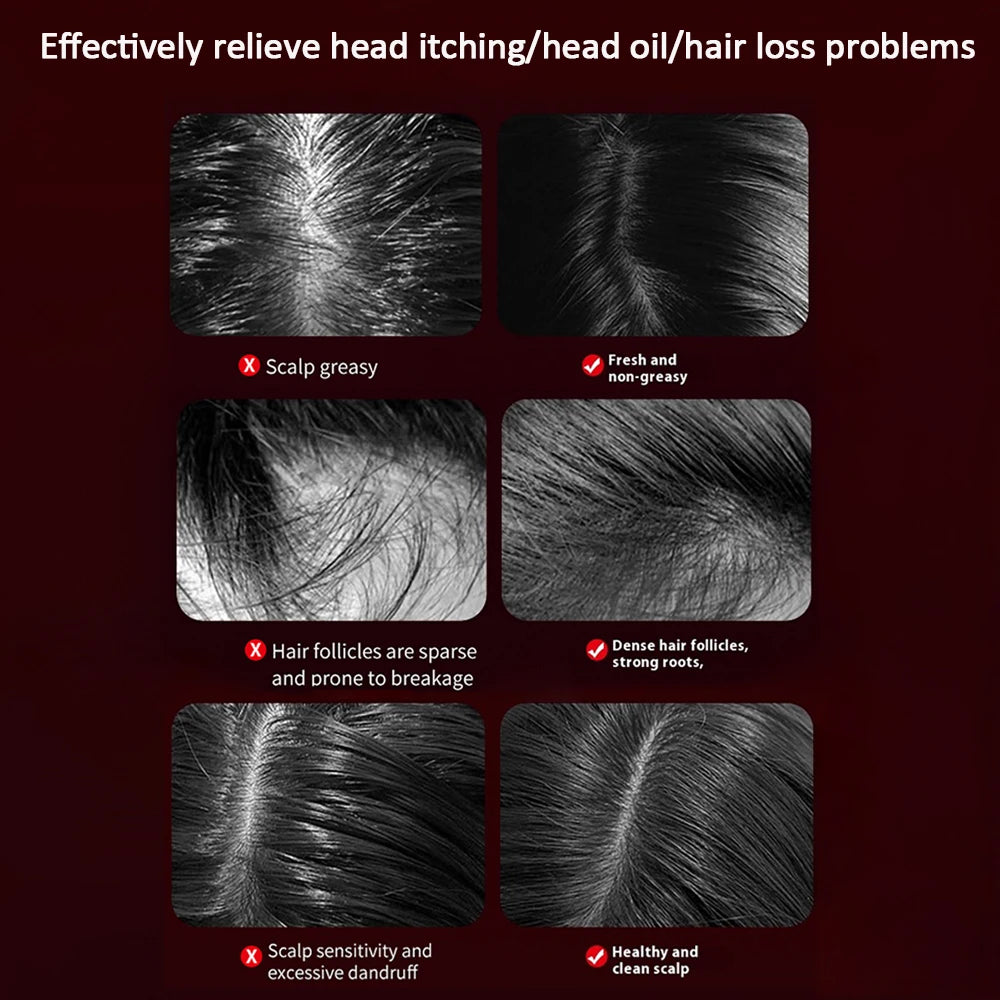 LuminaGrow™ Red Light Scalp Brush